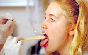 7 причин привкуса железа во рту у женщин и мужчин?