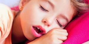Аденоиды у детей: симптомы, степени и лечение 68907 6