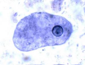 паразит Entamoeba histolytica