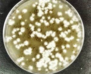 Анализ кала на кишечную группу: как производится посев кала на патогенную флору?