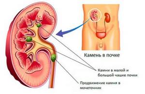 Анатомия мочеточника человека. Мочеточники и мочевой пузырь их положение строение функции. Патологии и исследования мочеточников