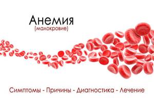 Анемия (малокровие) – особое состояние, характеризующееся уменьшением количества эритроцитов и гемоглобина в крови. Причины и симптомы анемии. Лечение анемии. Диета при анемии. Профилактика анемии