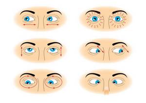 Астигматизм глаз у взрослых: что это такое, симптомы и лечение