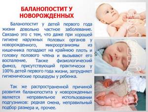Фото с описанием баланопостита у новорожденных