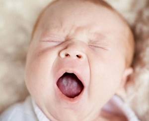 Причины белого налета на языке у младенца