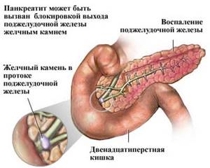 Боль в области желудка, отдающая в спину: причины, диагностика и лечение