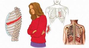 Боль в левом боку под ребрами спереди, сзади у женщин, в животе, ноющая боль при беременности, при нажатии