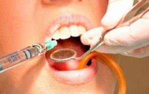 укол Лидокаина во время лечения зубов