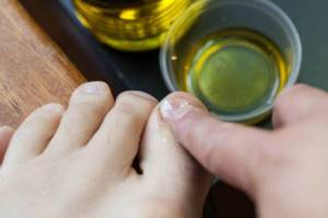 Как укрепить ногти, чтобы не слоились и не ломались в домашних условиях Причина ломкости, как лечить