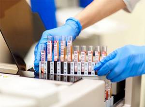 Что такое билирубин в анализе крови: повышен, что это значит, причины и лечение
