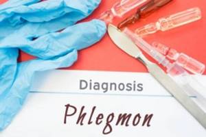 Что такое флегмона и чем она опасна? Всё о заболевании, диагностике и методах лечения