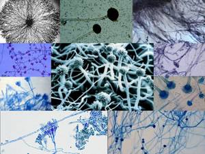 Что такое нити мицелия и как остановить их разрастание