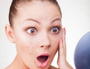 Демодекс на лице – как правильно выбрать эффективное лечение?