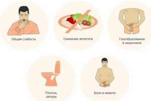 Основные симптомы дисбактериоза.