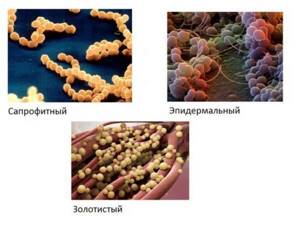 Эпидермальный стафилококк: характеристика, патогенность, диагностика, лечение