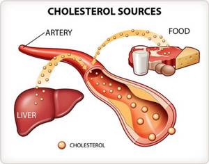 Повышение уровня холестерина в крови
