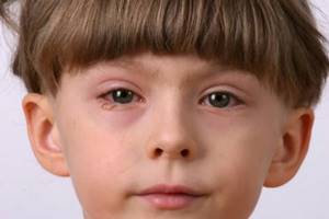 Глазные капли Левомицетин для детей: отзывы и инструкция