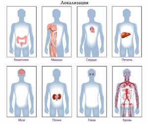 Данные органы. Локализация гельминта в организме. Локализация органов человека. Гельминты локализация у человека.