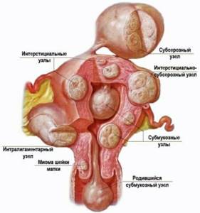 Какие бывают женские болезни по гинекологии: список, диагностика, симптомы и лечение