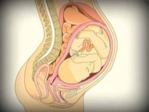 Какую можно использовать мазь при беременности при геморрое?