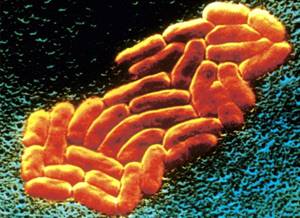 вид под микроскопом на клебсиеллу в кишечнике