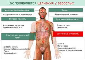 Боль в левой подвздошной области живота - News4Health.ru