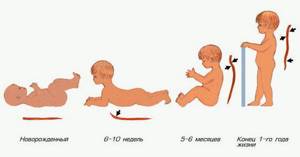 формирование физиологического поясничного лордоза у ребенка