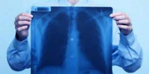 Народные средства от рака лёгких. Особенности лечения рака легких народными средствами