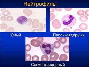 Нейтрофилы понижены в крови: более 5 причин, что это значит, как повысить уровень нейтрофилов у ребенка и взрослого. Опасна ли нейтропения