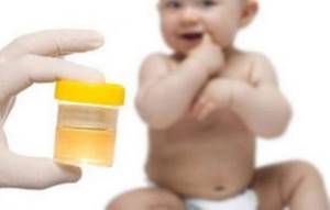 Нитриты, нитраты и бактерии в моче у ребенка: что это и по каким причинам появляется, как диагностируется и лечится?