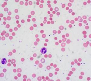 кровяные тельца под микроскопом