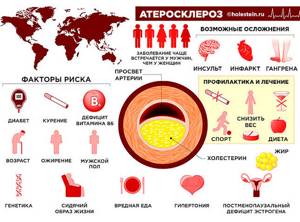 Атеросклероз инфографика