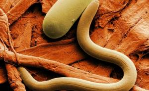Очищение организма от шлаков, токсинов, паразитов и антибиотиков в домашних условиях