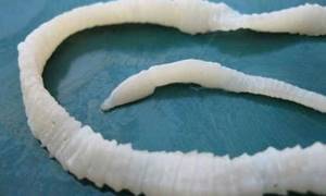 Цистит у мальчиков может появиться если в организме есть паразиты: острицы, аскариды, стронгилоиды (нитевидные черви