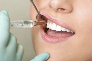 Атравматичное удаление зуба с предимплантационной подготовкой в ...