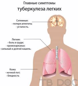 Главные симптомы туберкулеза легких