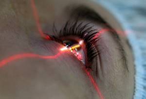 Отслоение сетчатки глаза: признаки, симптомы, причины