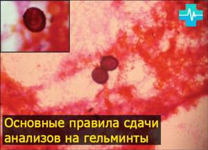 Анализы для выявления глистов - gemoparazit.ru