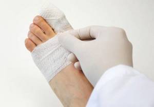 Перелом костей пальца на ноге: симптомы, признаки, лечение, восстановление