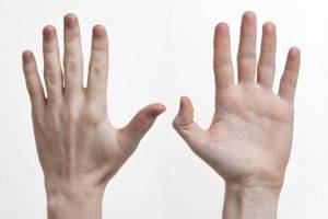 Длина поврежденного пальца может стать меньше длины здорового пальца на другой руке