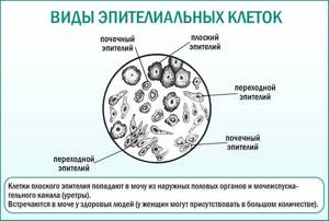 Эпителиальные клетки