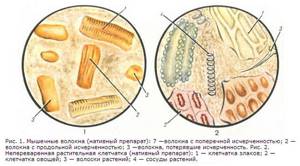 Микроскопическое исследование кала