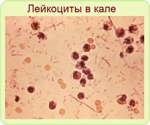 лейкоциты в кале