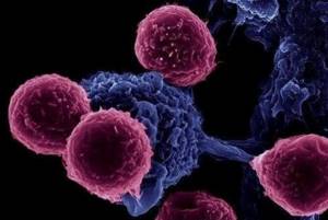 Поражение здоровых гепатоцитов клетками иммунитета