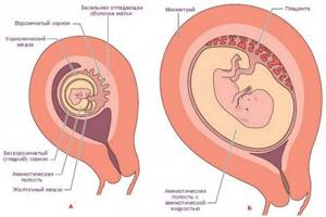 Отслойка плаценты на ранних и поздних сроках беременности. Симптомы, причины и последствия. Чем опасна, как происходит, лечение