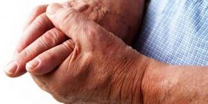 Причины, по которым немеет правая рука, известны многим врачам