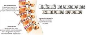 Причины появления боли в шее (в шейном отделе): методы лечения
