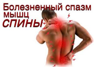 болезненный мышечный спазм мышц спины