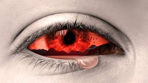 Проявления химического ожога глаз и действенное лечение в домашних условиях