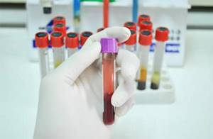 Расшифровка анализа и нормы показателей биохимии крови
